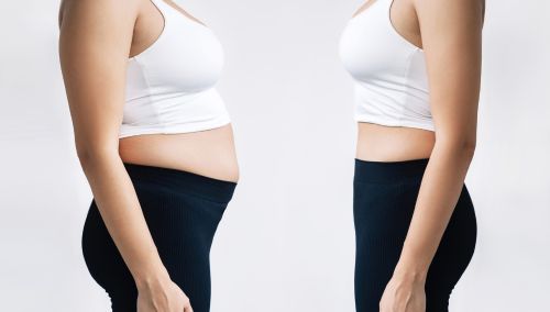 juvederm fillers before and after